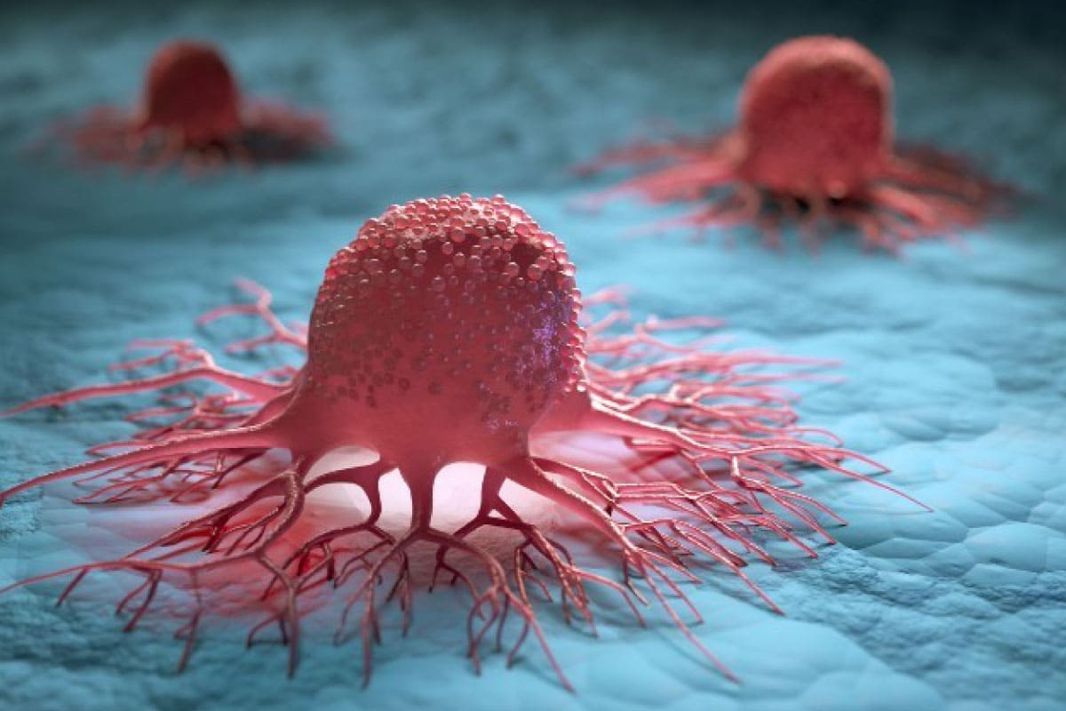Solid Tumors
